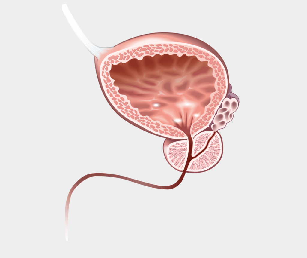 eine prostata