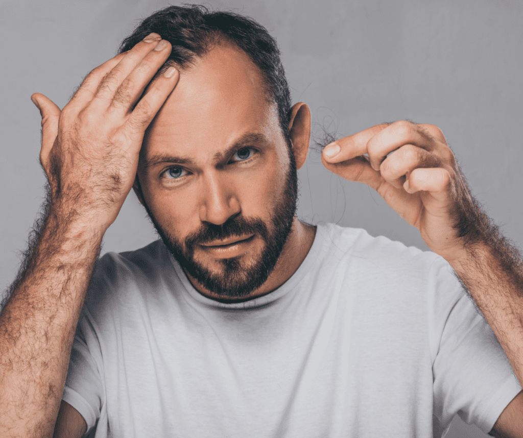 Haarausfall Männer zeigt einen Mann der Haarausfall bemerkt