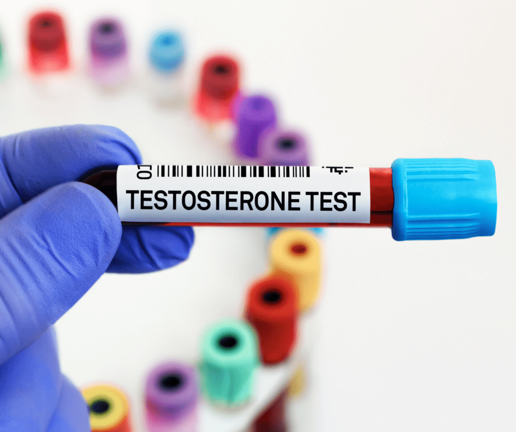 Testosteronüberschuss zeigt eine Kanüle mit Blut zum testen